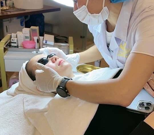 Bôi kem trị nám bị ngứa là do đâu