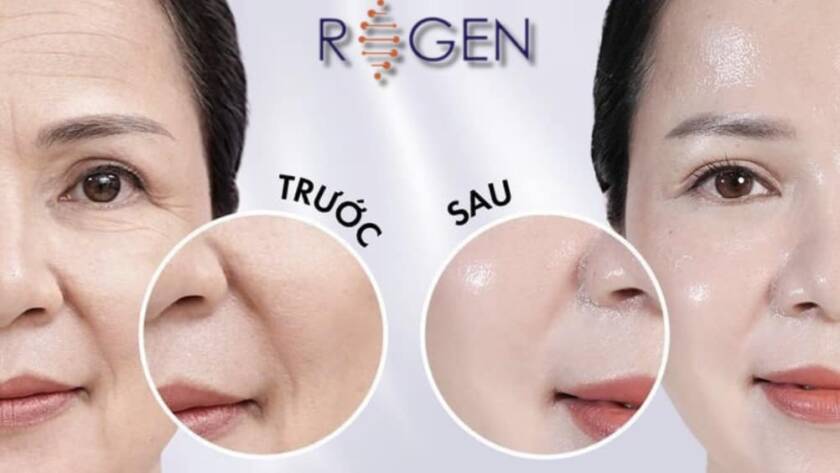 Căng mịn da là gì, tại sao da lại mất dần độ căng mịn ở sau tuổi 40