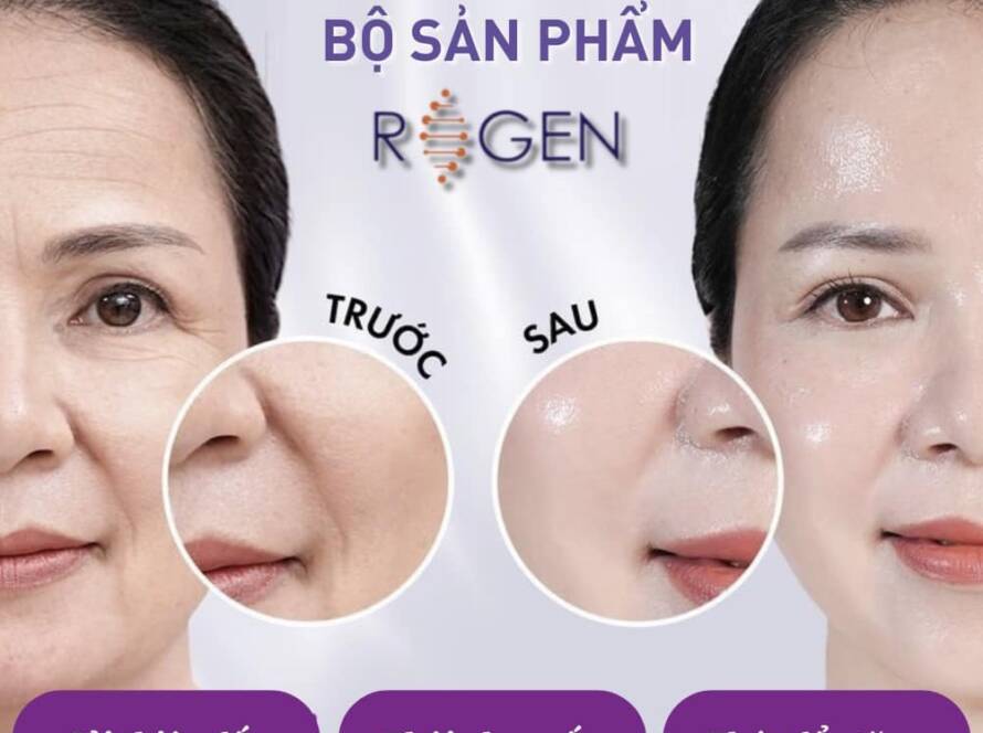 Căng mịn da là gì, tại sao da lại mất dần độ căng mịn ở sau tuổi 40