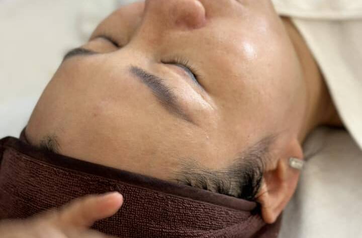 Nổi mụn thịt ở cổ là bệnh gì ?? Cách trị mụn thịt ở cổ tại nhà