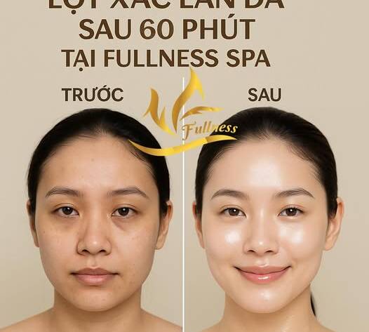 Hắc sắc tố gây thâm nám trên da gồm những gì