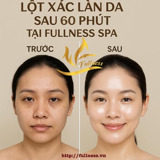 Hắc sắc tố gây thâm nám trên da gồm những gì
