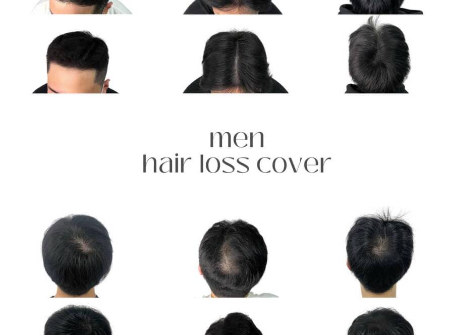 Khóa học tìm hiểu về tóc, cách điều trị rụng tóc tại nhà hiệu quả ?