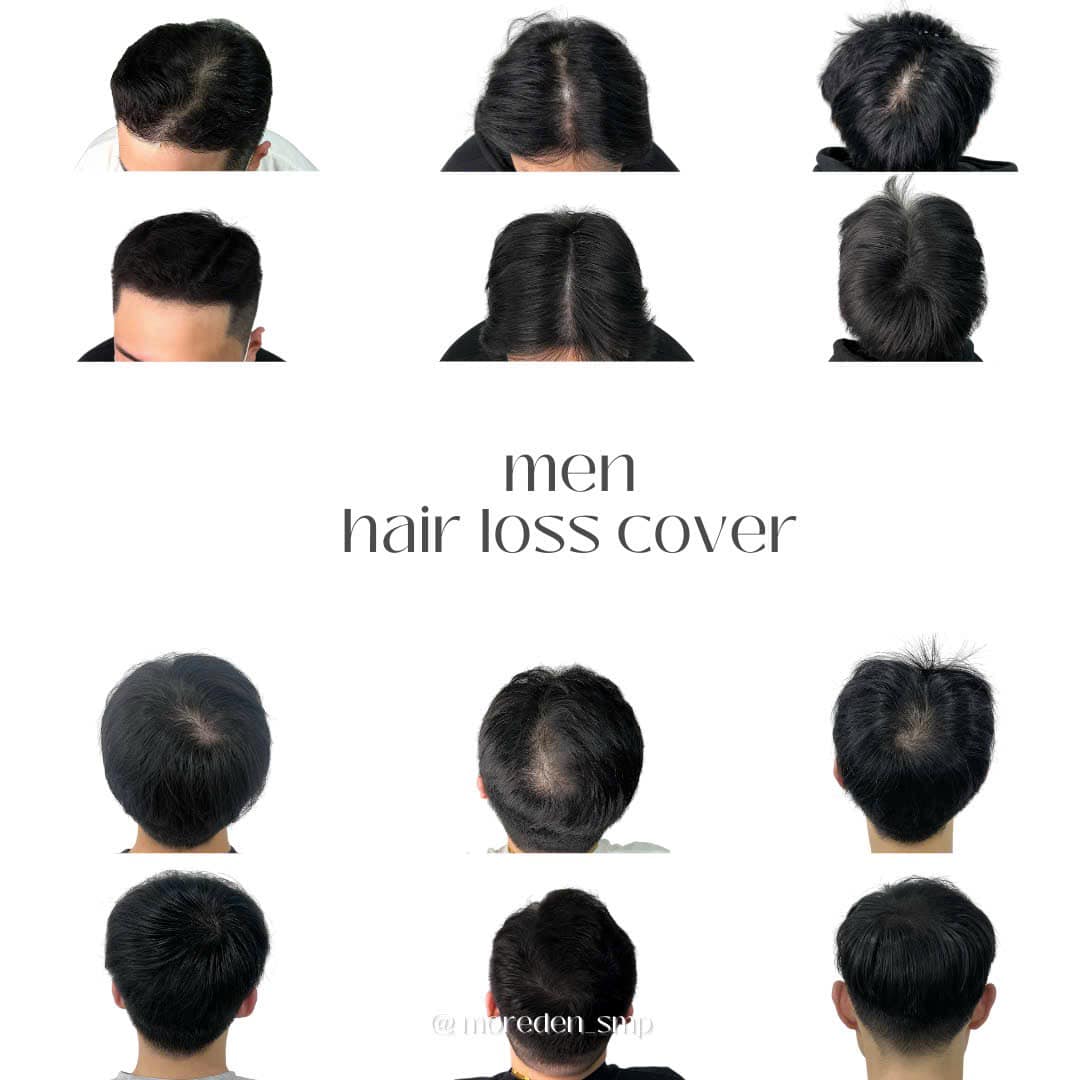 Khóa học tìm hiểu về tóc, cách điều trị rụng tóc tại nhà hiệu quả ?