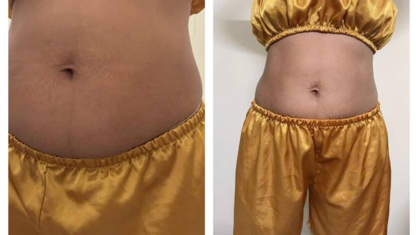 Khóa học Slimming