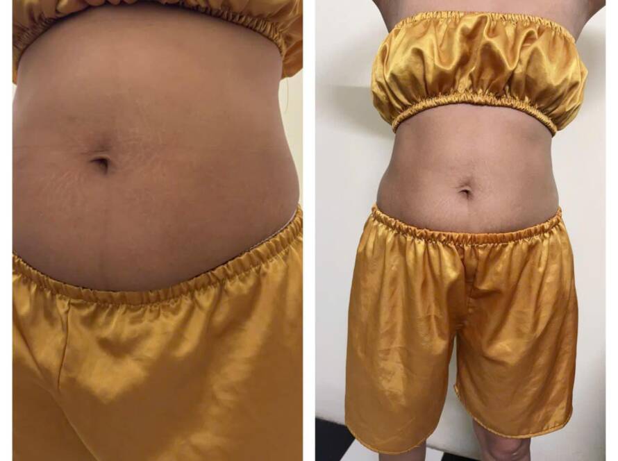 Khóa học Slimming