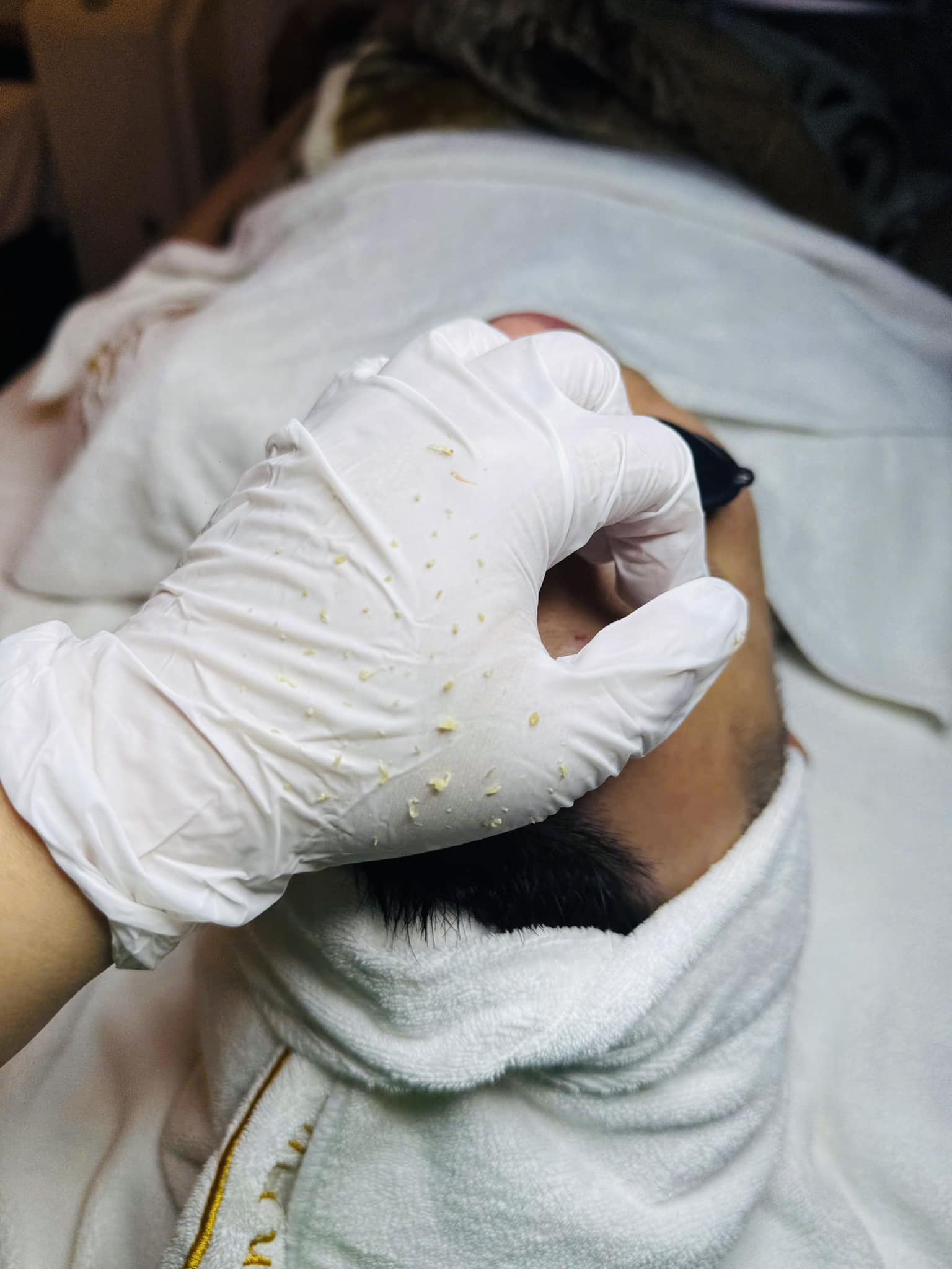 Khóa học điều trị da cơ bản: mụn và những điều bạn nên biết ?
