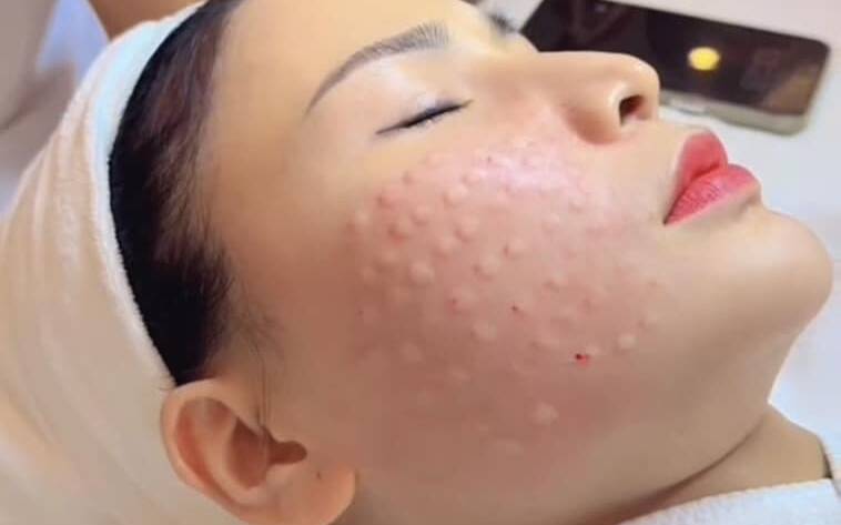 Khóa học tìm hiểu về viêm da tiếp xúc, hướng đi nào để điều trị hiệu quả ?