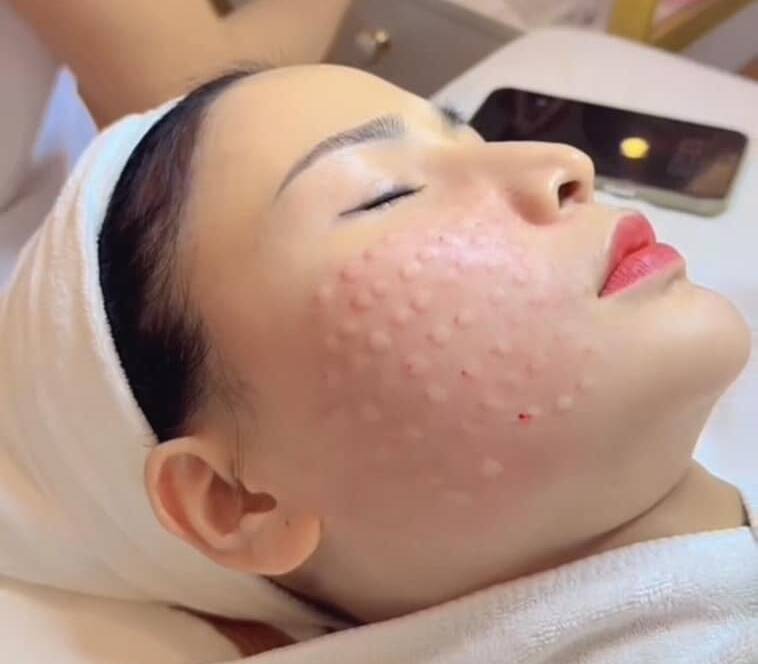 Khóa học tìm hiểu về viêm da tiếp xúc, hướng đi nào để điều trị hiệu quả ?