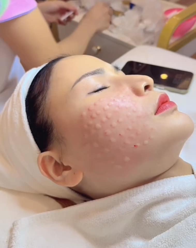 Khóa học tìm hiểu về viêm da tiếp xúc, hướng đi nào để điều trị hiệu quả ?