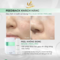 Làn da căng bóng, mịn màng thấy rõ sau 28 ngày sử dụng Wow Peeling