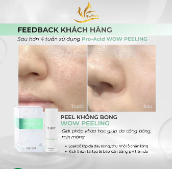 Làn da căng bóng, mịn màng thấy rõ sau 28 ngày sử dụng Wow Peeling