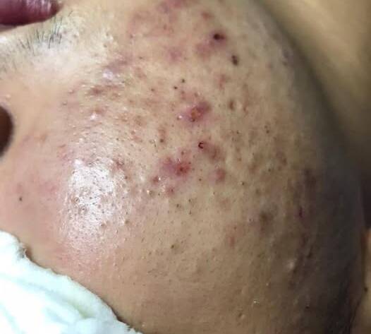 Fullness Spa nơi gửi trọn niềm tin cho làn da của bạn