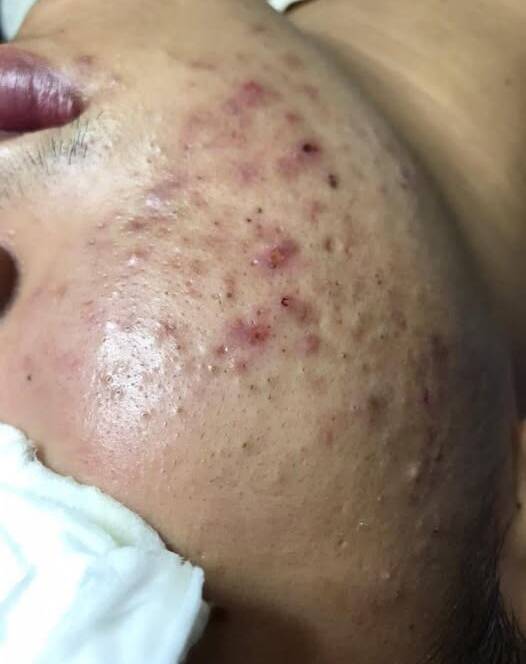 Fullness Spa nơi gửi trọn niềm tin cho làn da của bạn