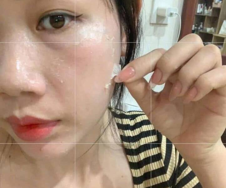 3 dấu hiệu chứng tỏ làn da phụ nữ cần được tẩy tế bào chết