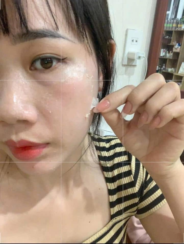3 dấu hiệu chứng tỏ làn da phụ nữ cần được tẩy tế bào chết