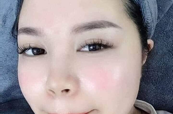 Cải tạo da lão hóa