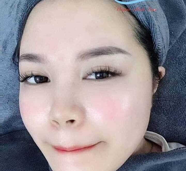 Cải tạo da lão hóa