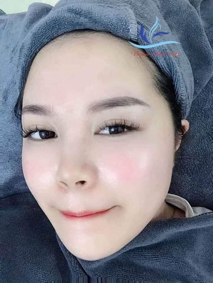 Cải tạo da lão hóa