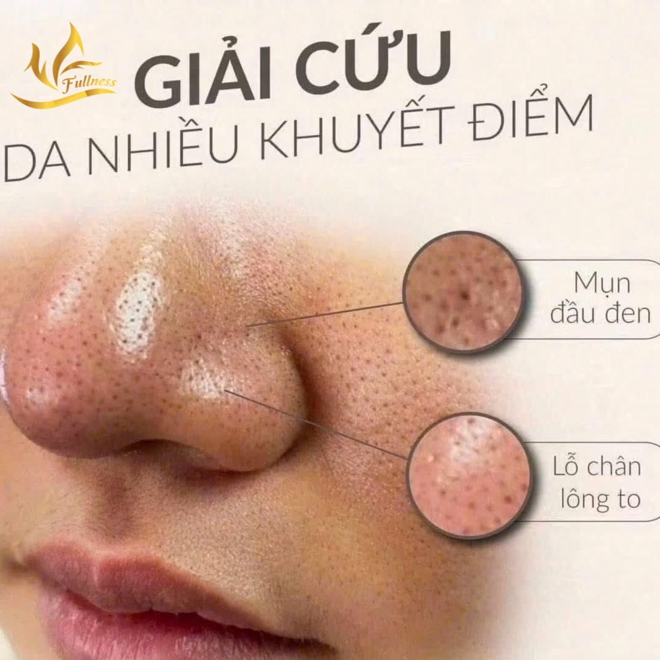 Hút dầu cho da mặt tại Spa sao cho đúng, cần có những lưu ý gì ?